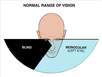 Range of Vision Left Eye