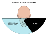 Range of Vision Right Eye
