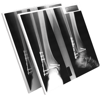 X-ray Prints